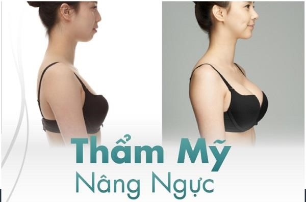 Top 8 địa chỉ nâng ngực đẹp và uy tín nhất ở Hải Phòng